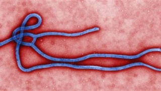 Ebola-Q&A