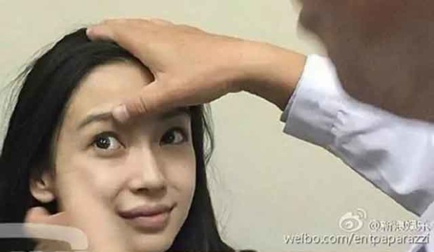 Angelababy-has-face-examined-to-quell-plastic-surgery-rumors