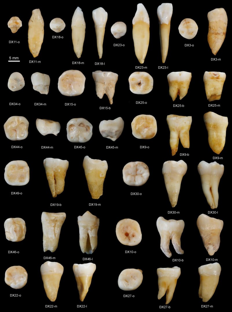 This photo provided by the journal Nature shows human lower teeth found in the Fuyan Cave of Hunan province in southern China. They are among dozens of fossil human teeth more than 80,000 years old that were recovered from the cave, providing the oldest clear indication by far that people lived in southern Asia that long ago. Maria Martinon-Torres, of University College London in England, and colleagues report the discovery in a paper released by the journal Nature on Wednesday, Oct. 14, 2015. (S. Xing/Nature via AP)
