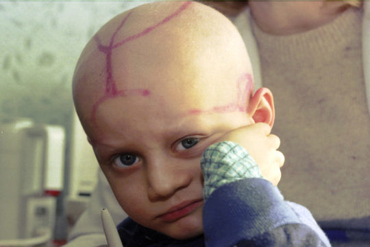 Five-year-old Alek Zhloba, who suffers from leukemia.