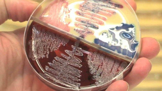 Ph.D. student creates new way to treat antibiotic resistance