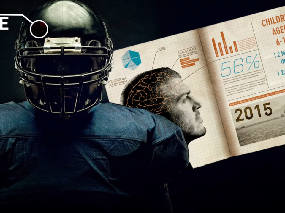 Study links brain injuries with American football