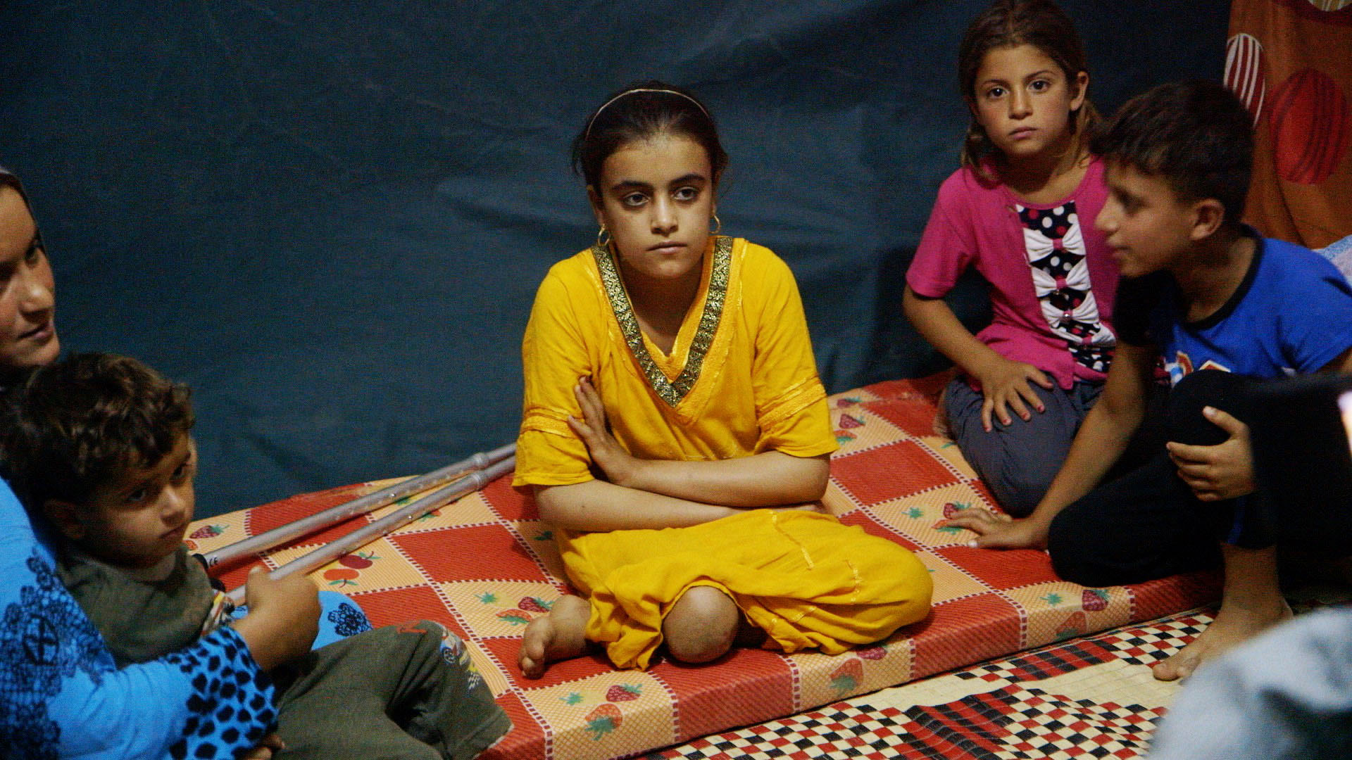 A young girl who lost her leg to an Islamic State attack fled with her family, and is now living in a camp. The conflict has displaced more than 7.6 million people in Syria, and more than 3.3 million in Iraq. 