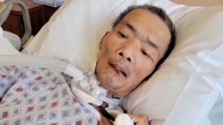 Death of attacked Chinese man raises concern in U.S.