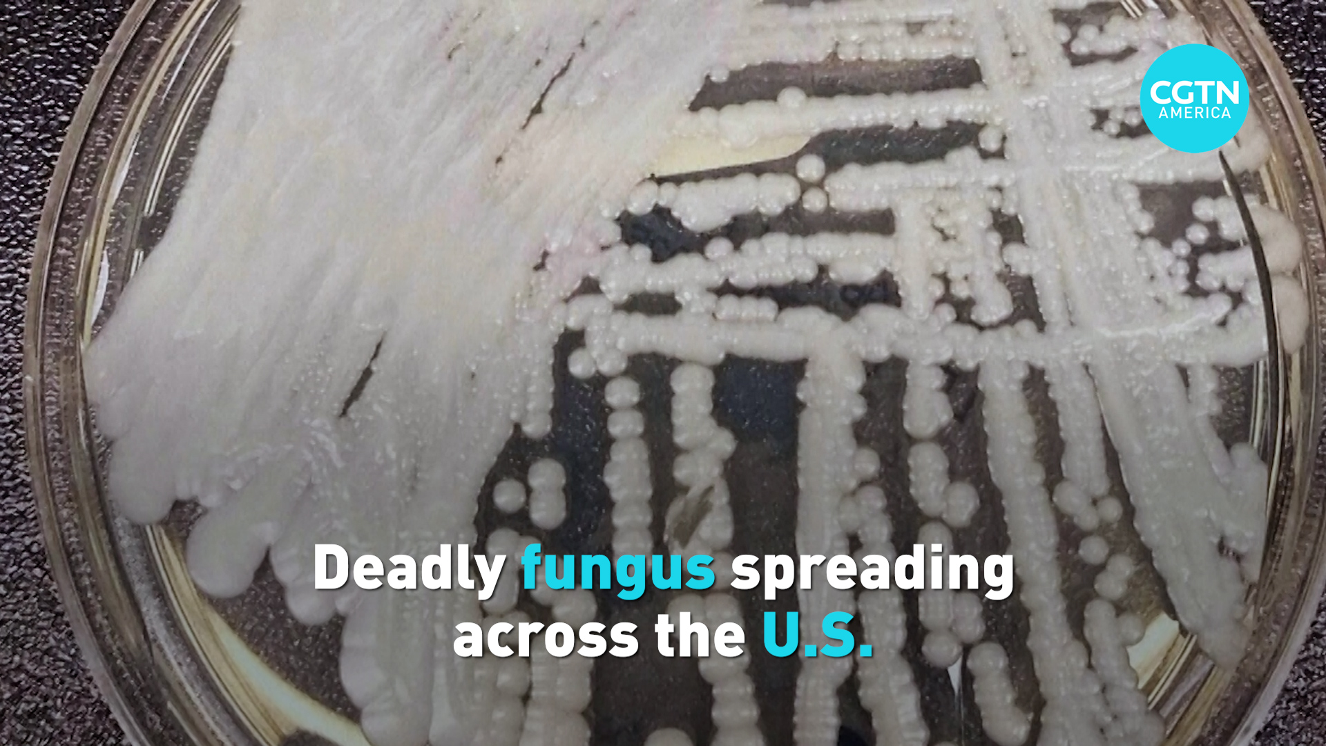 Deadly fungus spreading across the U.S. CGTN America