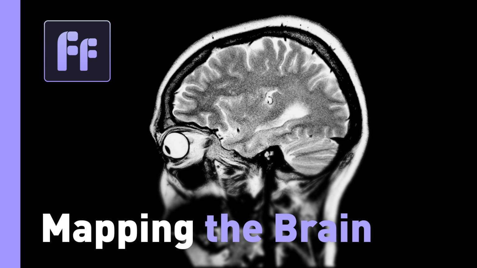 Mapping The Brain